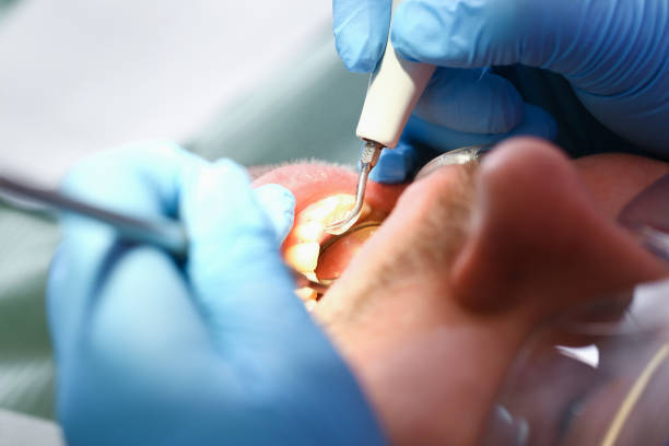 Best Broken or Cracked Tooth Emergency Dentist in Russellville, AR