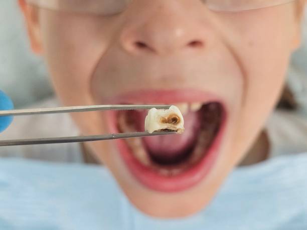 Best Emergency Cosmetic Dentistry in Russellville, AR