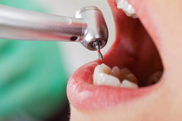 Best Emergency Dentist for Special Needs Patients in Russellville, AR